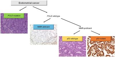 Integrated clinicopathologic and molecular analysis of endometrial carcinoma: Prognostic impact of the new ESGO-ESTRO-ESP endometrial cancer risk classification and proposal of histopathologic algorithm for its implementation in clinical practice